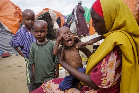 Famine & Child Hunger Crisis .